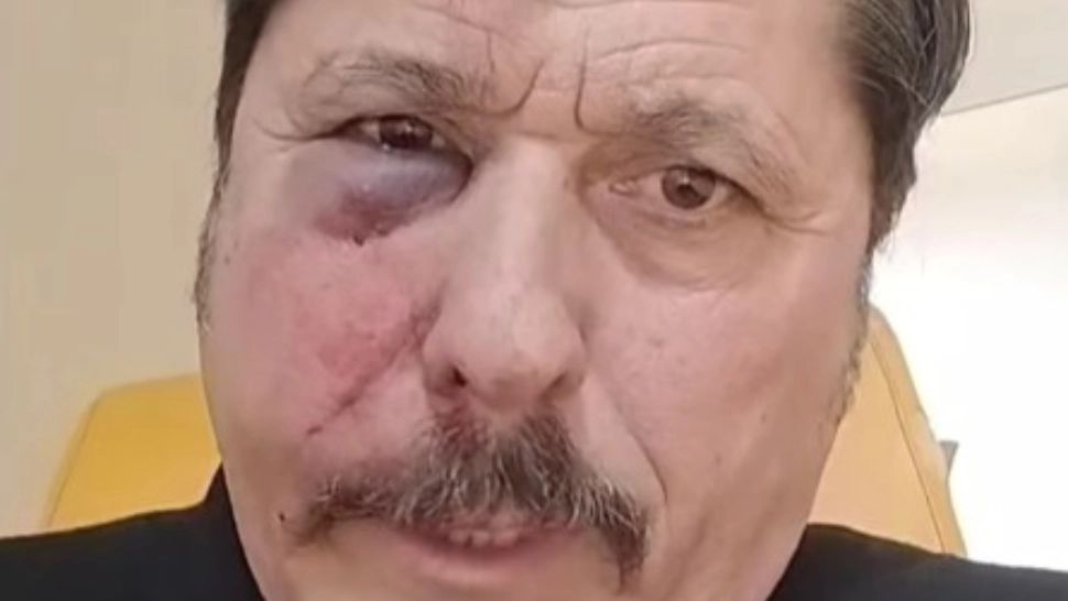 Noi detalii despre consilierul AUR bătut într o ședință de consiliu din Ilfov. Bărbatul a ajuns la spital și a fost operat de urgență