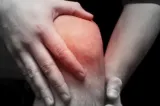 Instabilitatea rotulei după un traumatism