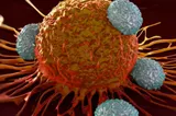 Agenția americană pentru medicamente aprobă un tratament inovator pentru cancerul pancreatic