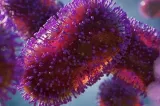 „Astmul de furtună”, pericolul ascuns al verii. Medicii avertizează că poate afecta și copiii fără diagnostic