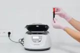 De ce cresc enzimele hepatice? Ce spun specialiștii laboratoarelor Clinica Sante