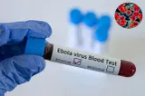 Epidemia de Ebola se extinde. Cinci țări, afectate de focarul mortal: Nigeria este ultimul stat afectat