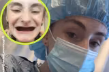 O tânără și-a pierdut toți dinții la 25 de ani din cauza malnutriției severe. Povestea care i-a șocat pe medici