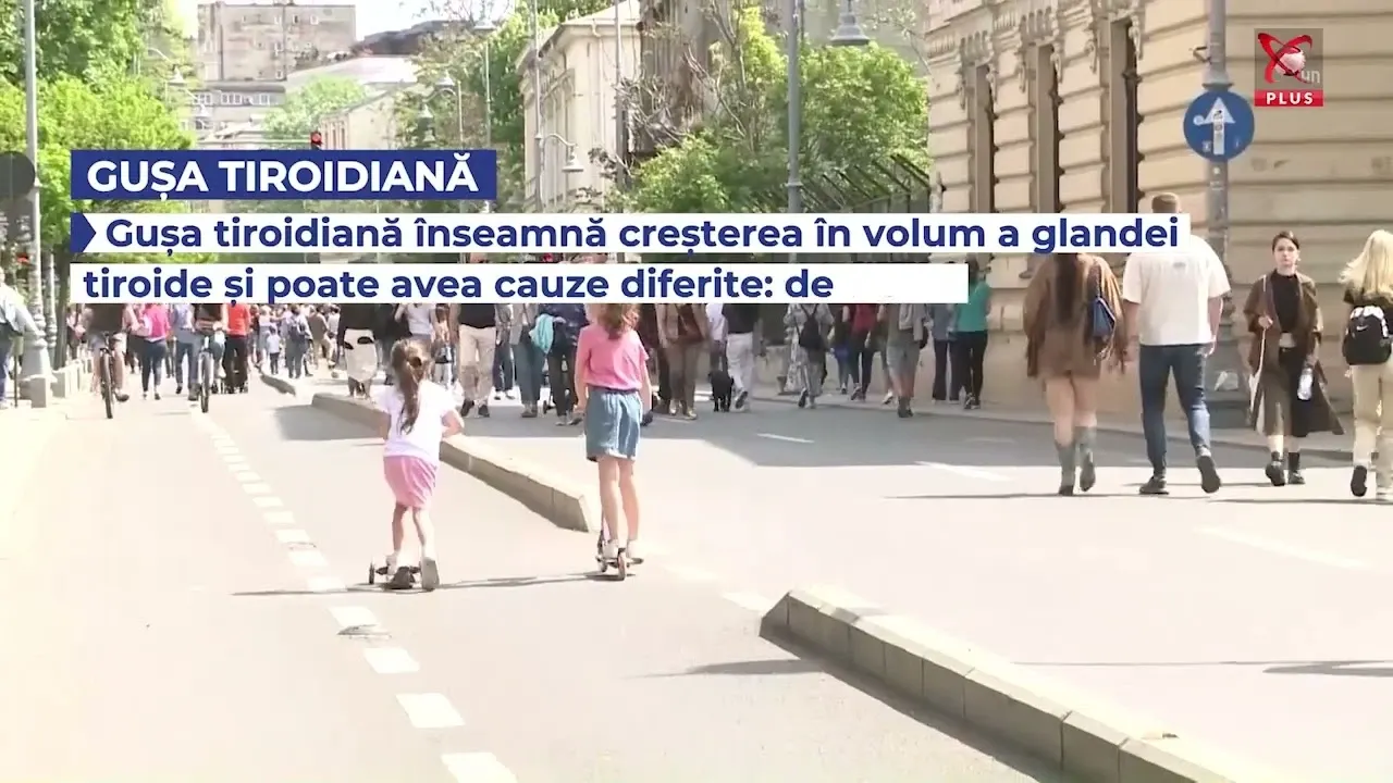 Glanda tiroidă