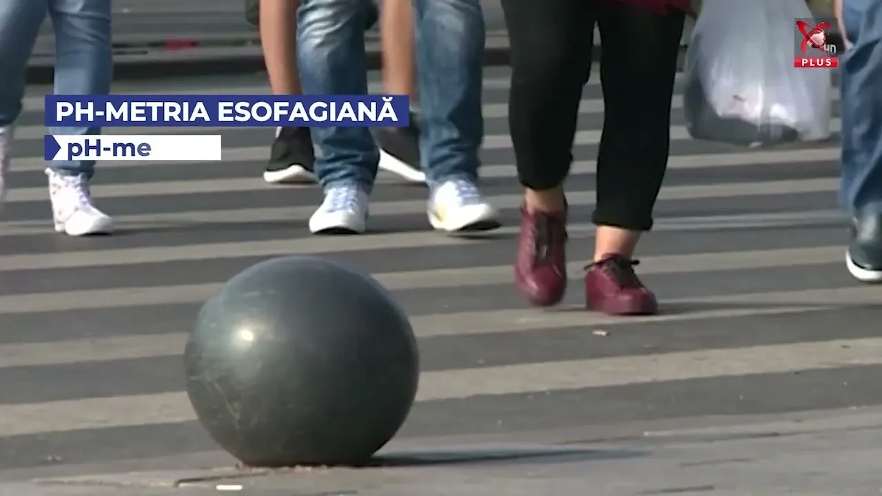  Monitorizarea acidității care explică refluxul