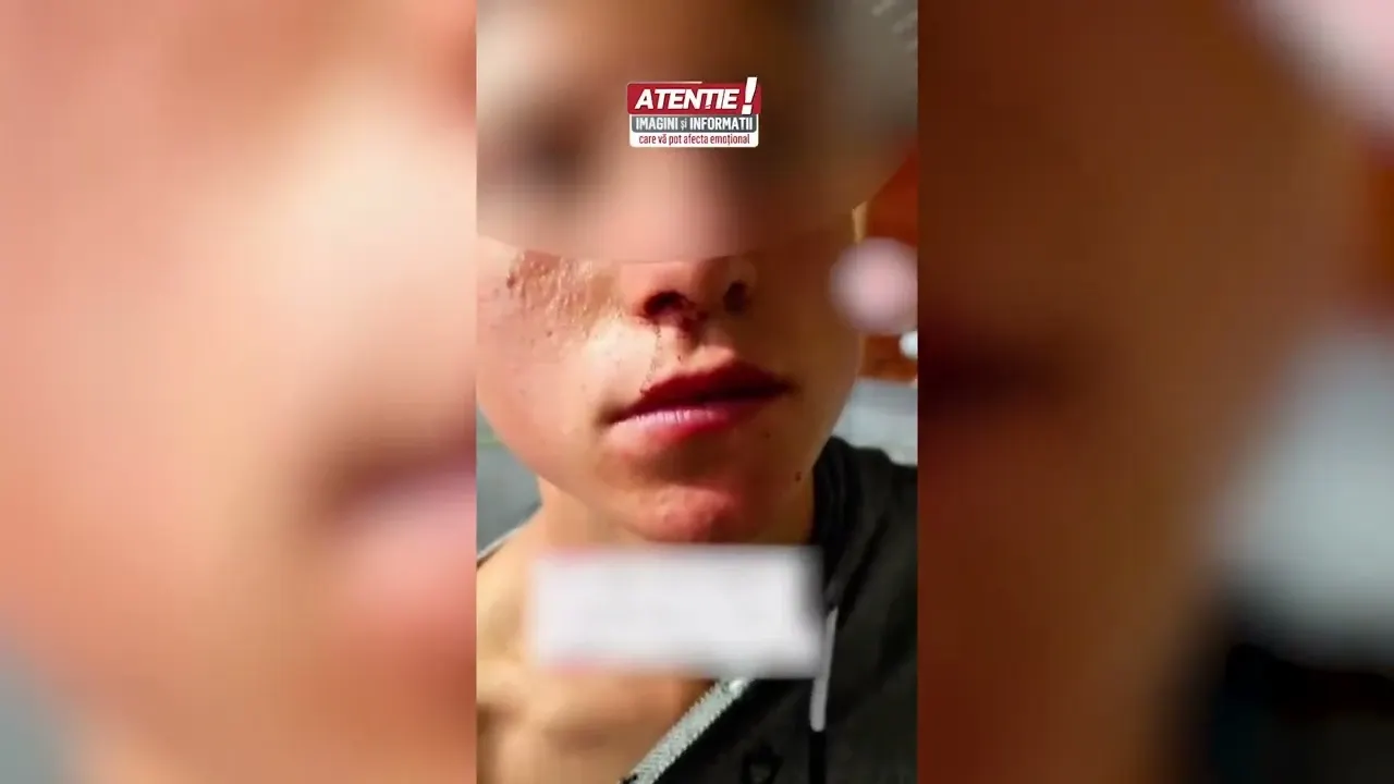Copil de 14 ani batut pe camp