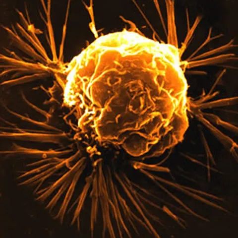 Extractul din seminţe de struguri duce la autodistrugerea celulelor canceroase