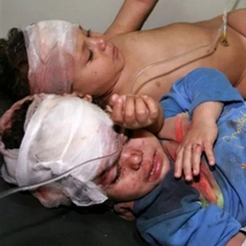 Belgia se declară dispusă să-i primească pe copiii răniţi în timpul ofensivei din Fâşia Gaza