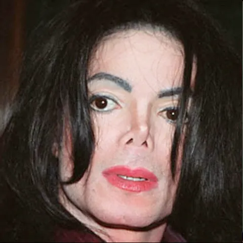 Michael Jackson rămâne fără piele
