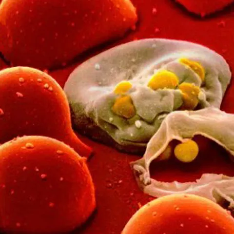 Virusul HIV suferă în permanenţă mutaţii