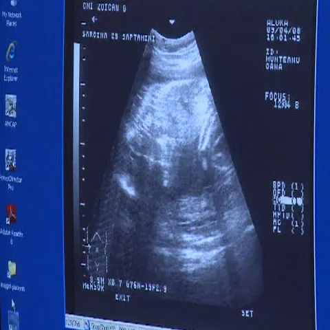 Doi tineri din Bacău susţin că fetiţei lor i-a fost ruptă clavicula la naştere 