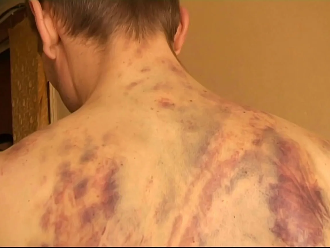 Tânăr bătut cu brutalitate de către autorităţile moldovene