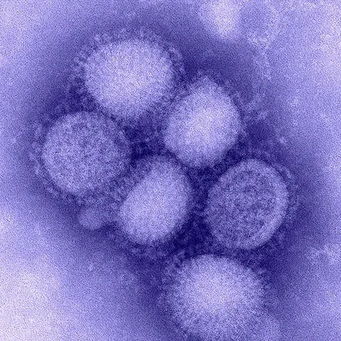 Ciprul anunţă primul său caz de gripă porcină, o femeie originară din R. Moldova