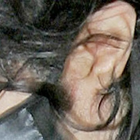 Urechea mutilată a lui Michael Jackson - FOTO