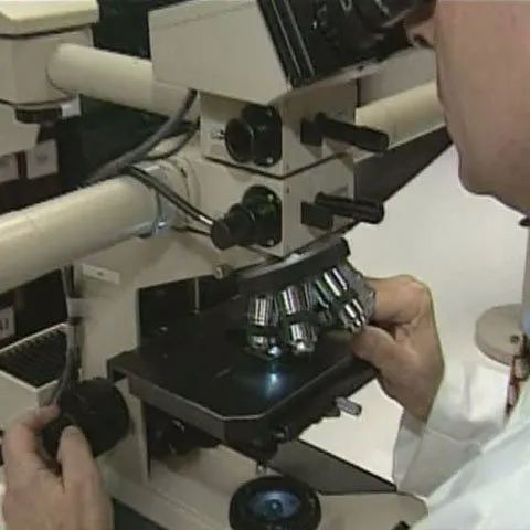 Cancerul este legat de evoluţia speciei umane, potrivit unor cercetători israelieni