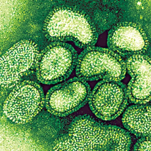 New swine flu case in Romania comes from Turkey, count reaches 56