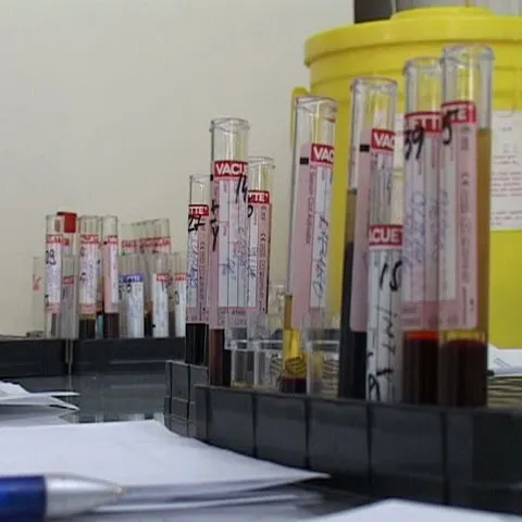 Pacienţii din judeţul Alba sunt nevoiţi să plătescă analizele medicale gratuite