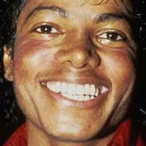 Copiii râdeau de nasul borcănat al lui Michael Jackson