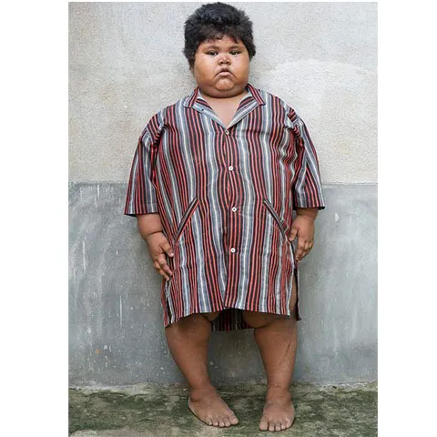 O fetiţă din India cântăreşte 76 de kilograme la doar 5 ani
