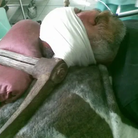 Un tânăr polonez a încercat să îşi ucidă tatăl lovindu-l cu un târnăcop în cap 