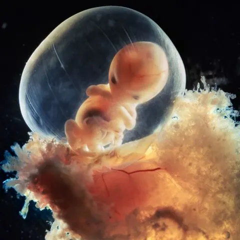 Fotografii incredibile: dezvoltarea unui fetus în uter - VEZI GALERIE