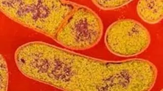 Botulism/Foto:scienceline.ro