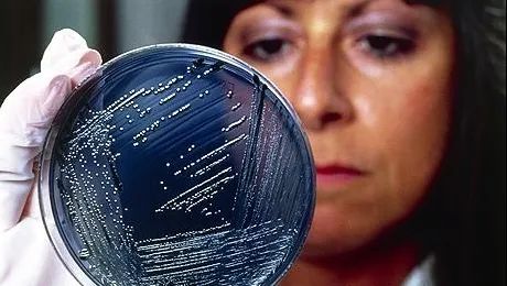 Simptomele infecţiei cu Salmonella