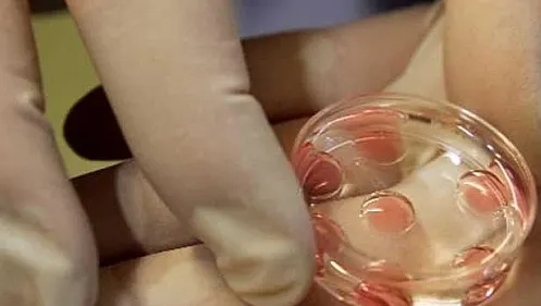 Dosarele pentru programul de fertilizare în vitro se depun de la 15 iunie. Ce condiţii sunt impuse