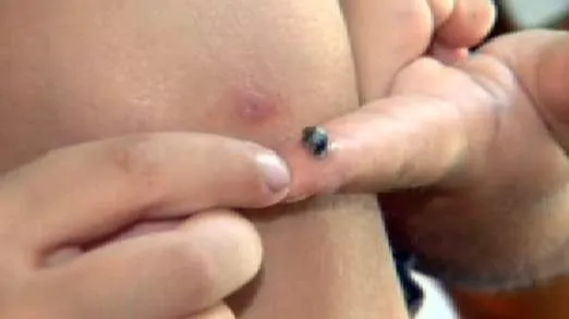 Ce a păţit un băieţel, după ce a căzut pe plajă. Descoperirea șocantă făcută de mama sa în rană