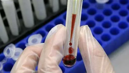 Sute de analize medicale pentru depistarea HIV, falsificate la Spitalul Judeţean din Tg.Jiu