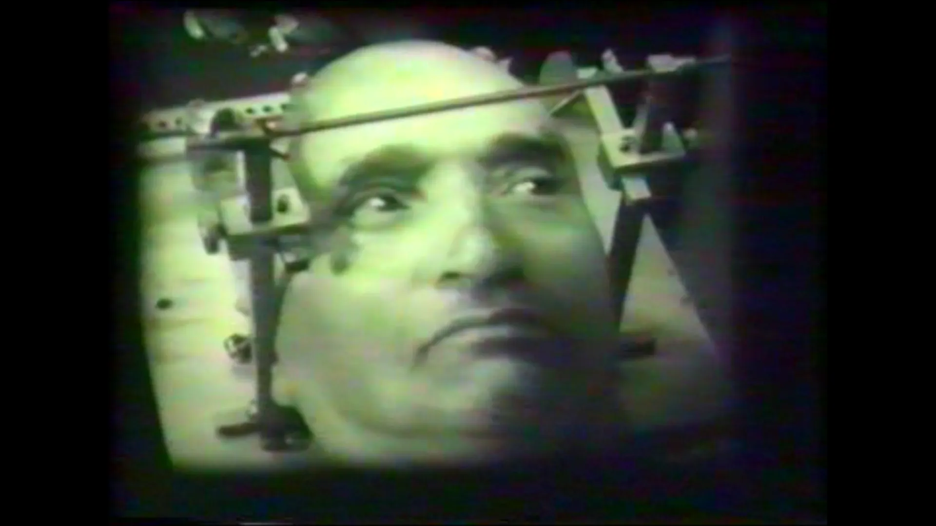 Imagini spectaculoase din timpul PRIMEI OPERAŢII PE CREIER din România. Filmul datează din 1973