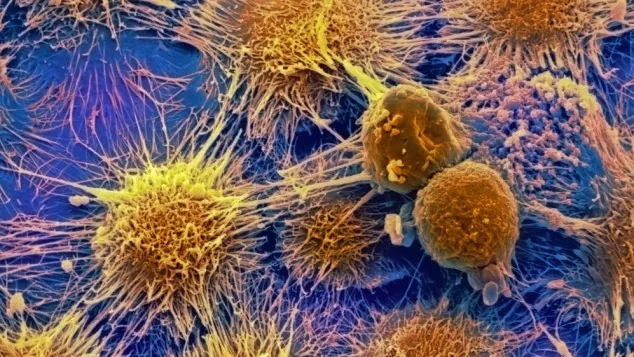 DESCOPERIRE. Leguma banală care ne poate feri de cancer