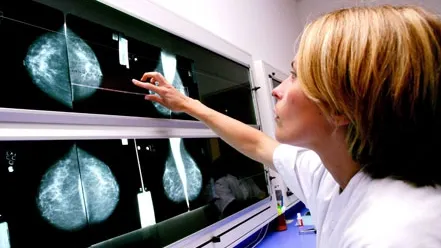 Revoluţie în lupta ANTICANCER. "Pentru prima oară, se văd rezultatele"