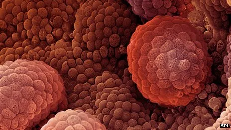 Medicamentul care previne cea mai agresiva forma de cancer