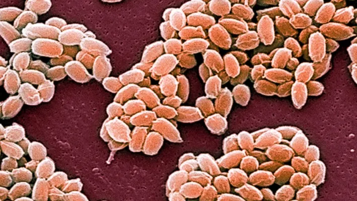 ALERTĂ DE ANTRAX la graniţa cu România. Infecţia, depistată în CARNEA DE VITĂ