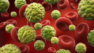 La ce formă de cancer eşti predispus, în funcţie de grupa de sânge