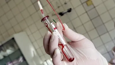 MALADIA TĂCUTĂ care face ravagii în România. Se transmite prin fluidele corporale, dar şi prin sânge