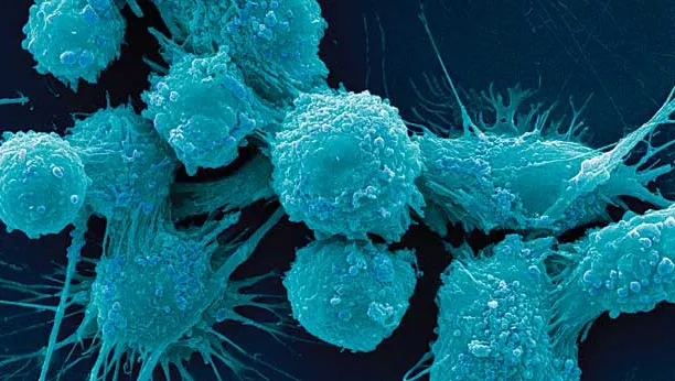 DESCOPERIRE. Remediul neaşteptat pentru cancer. Îl avem în bucătărie şi nu ştiam