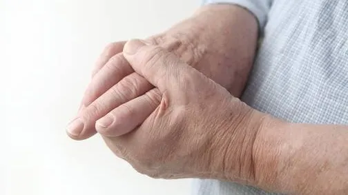 Află cum poți preveni GUTA, o afecțiune inflamatorie din ce în ce mai răspândită
