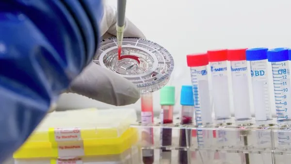 TEST RAPID pentru depistarea EBOLA