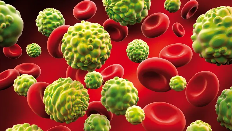 Ce trebuie să mâncăm pentru a preveni cancerul de colon