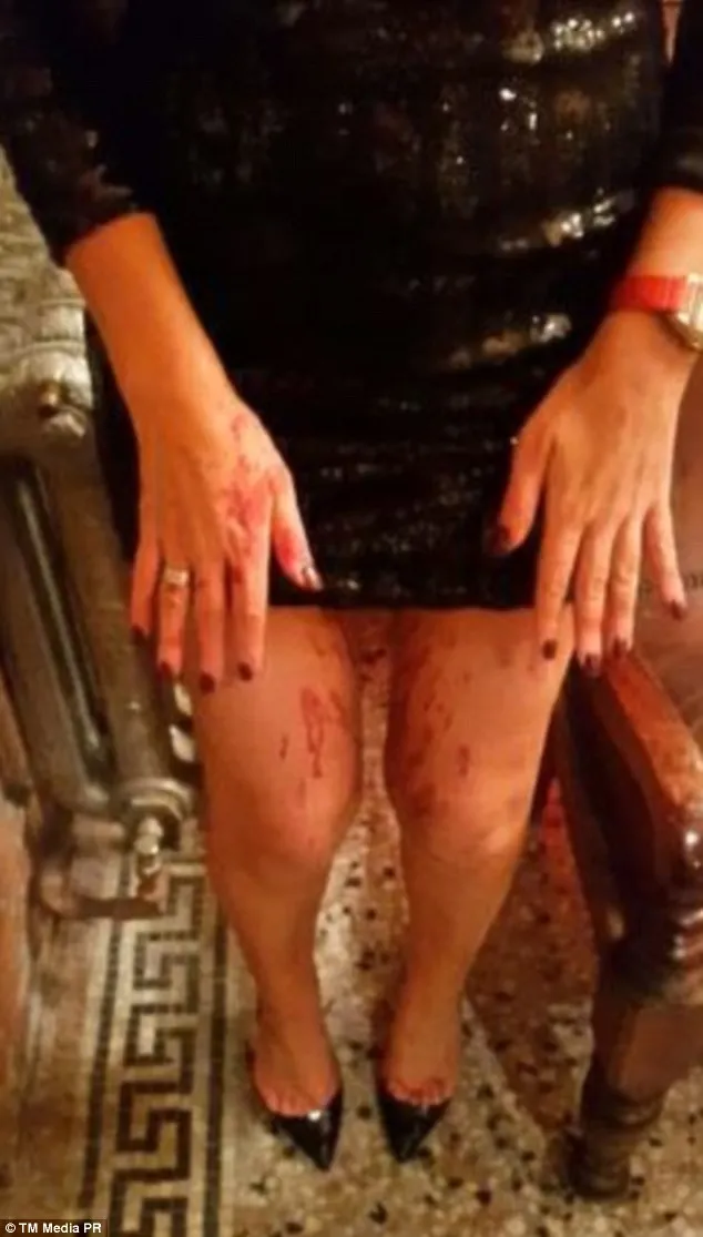 MODEL bătut cu bestialitate, într-un club. A fost atacată de NECUNOSCUŢI