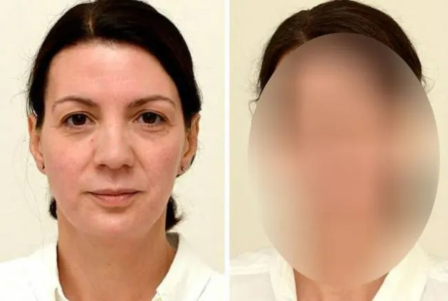 FĂRĂ CUVINTE! Ce s-a întâmplat cu o femeie după ce, timp de o lună, a băut trei litri de apă pe zi