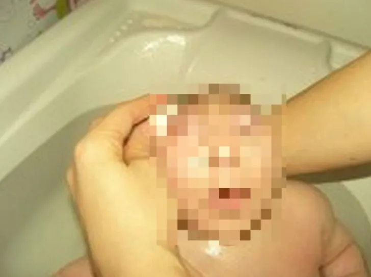 A băut, a fumat tot timpul sarcinii. Cum arată copilul la naştere: medicii au intrat în stare de ŞOC