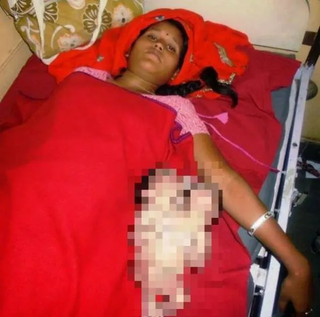 Medicii, în șoc după ce au văzut ce a născut această femeie: "Nu am văzut așa ceva în 40 de ani!"