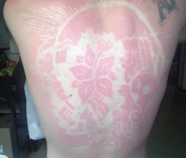 "Tatuajele solare", noul trend care face ravagii pe internet