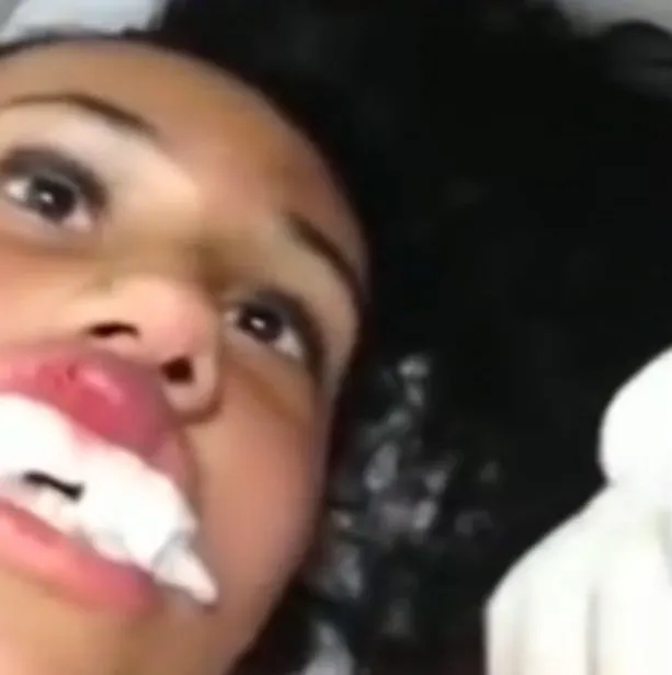 Credeau că are botox în buze, dar când s-au uitat mai atenți au rămas şocaţi