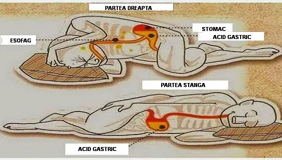 Pe ce parte este cel mai bine să dormi