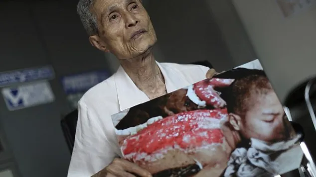 Imagini sfâșietoare. Cicatricile lăsate pe trupul unui bătrân de explozia de la Nagasaki