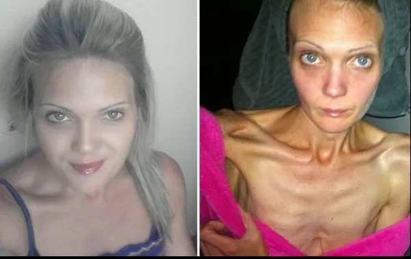 A primit o scrisoare de la mama ei. Vestea cumplită care a făcut-o să ajungă la doar 34 kg